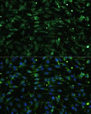 Immunocytochemistry/Immunofluorescence: Muscarinic Acetylcholine Receptor M1/CHRM1 Antibody [NBP2-94811] - Analysis of C6 cells using Muscarinic Acetylcholine Receptor M1/CHRM1 at dilution of 1:100. Blue: DAPI for nuclear staining.