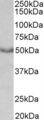 Western Blot: Muscarinic Acetylcholine Receptor M1/CHRM1 Antibody [NB100-41399] - Staining of mouse heart lysate (35 ug protein in RIPA buffer). Primary incubation was 1 hour. Detected by chemiluminescence.