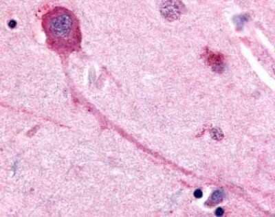 Immunohistochemistry-Paraffin: Muscarinic Acetylcholine Receptor M2/CHRM2 Antibody [NLS1831] - Analysis of anti-CHRM2 antibody with brain, neurons and glia.