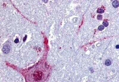 Immunohistochemistry-Paraffin: Muscarinic Acetylcholine Receptor M3/CHRM3 Antibody - BSA Free [NB100-58978] - Analysis of anti-CHRM3 / M3 antibody with human brain, cortex at oncentration 5 ug/ml.