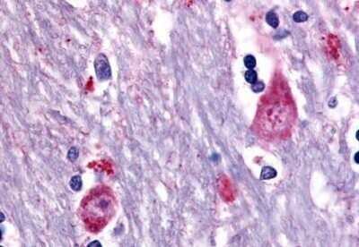 Immunohistochemistry-Paraffin: Muscarinic Acetylcholine Receptor M3/CHRM3 Antibody - BSA Free [NB100-59004] - Analysis of anti-CHRM3 / M3 antibody with human brain, caudate concentration 10 ug/ml.