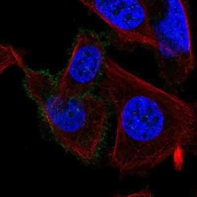 Immunocytochemistry/Immunofluorescence: Muscarinic Acetylcholine Receptor M3/CHRM3 Antibody [NBP2-56624] - Staining of human cell line PC-3 shows localization to plasma membrane. Antibody staining is shown in green. 