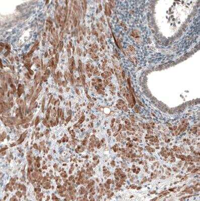 Immunohistochemistry-Paraffin: Muscarinic Acetylcholine Receptor M3/CHRM3 Antibody [NBP1-87547] - Staining of human prostate shows moderate to strong membranous and cytoplasmic positivity in smooth muscle cells.