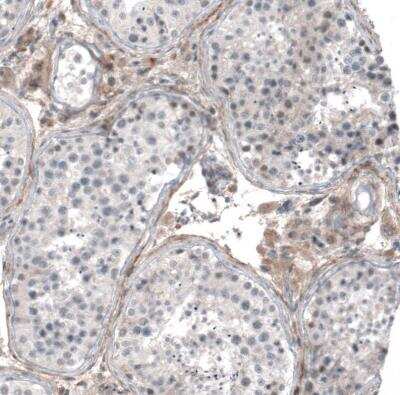 Immunohistochemistry-Paraffin: Muscarinic Acetylcholine Receptor M3/CHRM3 Antibody [NBP1-87547] - Staining of human testis shows moderate cytoplasmic positivity in Leydig cells.