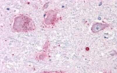 Immunohistochemistry-Paraffin: Muscarinic Acetylcholine Receptor M3/CHRM3 Antibody [NLS5259] - Anti-CHRM3 / M3 antibody IHC of human brain, neurons and glia. Immunohistochemistry of formalin-fixed, paraffin-embedded tissue after heat-induced antigen retrieval.