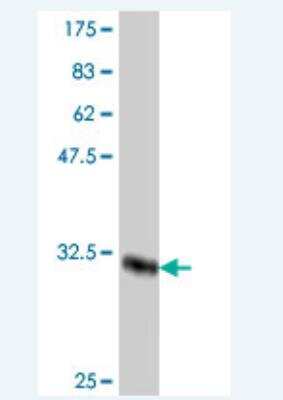 Western Blot: Muscarinic Acetylcholine Receptor M3/CHRM3 Antibody [H00001131-A01] - Western Blot detection against Immunogen (33.48 KDa) .