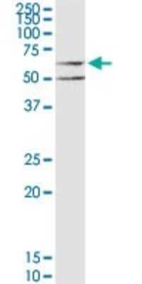 Western Blot: Muscarinic Acetylcholine Receptor M3/CHRM3 Antibody [H00001131-B01P] - Analysis of CHRM3 expression in HeLa.