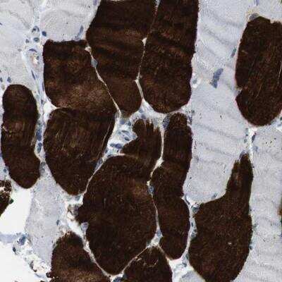 Immunohistochemistry-Paraffin: Muscarinic Acetylcholine Receptor M5/CHRM5 Antibody [NBP1-87578] - Staining of human skeletal muscle shows strong cytoplasmic positivity in myocytes.