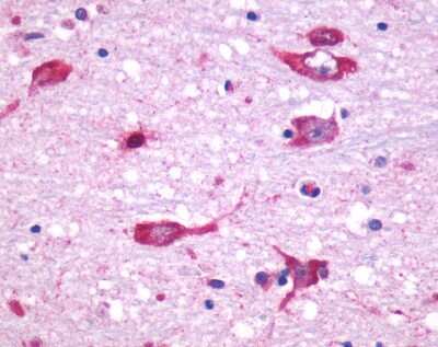 Immunohistochemistry-Paraffin: Muscarinic Acetylcholine Receptor M5/CHRM5 Antibody [NLS1334] - Analysis of anti-CHRM5 antibody with human brain, neurons and glia at 10 ug/ml.