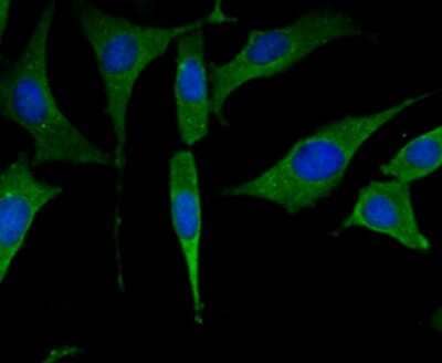 Immunocytochemistry/Immunofluorescence: Muscle Phosphofructokinase/PFKM/PFK-1 Antibody (JU53-31) [NBP2-75578] - Staining Fructose 6 Phosphate Kinase in SH-SY-5Y cells (green). The nuclear counter stain is DAPI (blue). Cells were fixed in paraformaldehyde, permeabilised with 0.25% Triton X100/PBS.