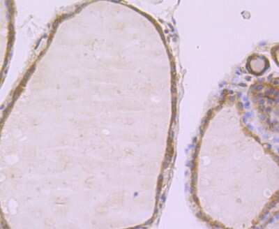 Immunohistochemistry-Paraffin: Muscle Phosphofructokinase/PFKM/PFK-1 Antibody (JU53-31) [NBP2-75578] - Analysis of paraffin-embedded human thyroid gland tissue using anti-Fructose 6 Phosphate Kinase antibody. Counter stained with hematoxylin.