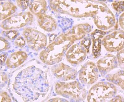 Immunohistochemistry-Paraffin: Muscle Phosphofructokinase/PFKM/PFK-1 Antibody (JU53-31) [NBP2-75578] - Analysis of paraffin-embedded human kidney tissue using anti-Fructose 6 Phosphate Kinase antibody. Counter stained with hematoxylin.