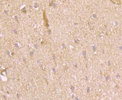 Immunohistochemistry-Paraffin: Muscle Phosphofructokinase/PFKM/PFK-1 Antibody (JU53-31) [NBP2-75578] - Analysis of paraffin-embedded rat brain tissue using anti-Fructose 6 Phosphate Kinase antibody. Counter stained with hematoxylin.