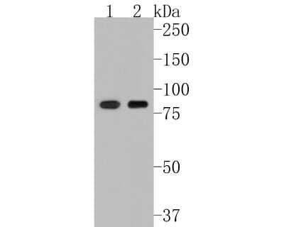 Western Blot: Muscle Phosphofructokinase/PFKM/PFK-1 Antibody (JU53-31) [NBP2-75578] - Western blot analysis of Muscle Phosphofructokinase/PFKM/PFK-1 on different lysates. Proteins were transferred to a PVDF membrane and blocked with 5% BSA in PBS for 1 hour at room temperature. The primary antibody (1/500) was used in 5% BSA at room temperature for 2 hours. Goat Anti-Rabbit IgG - HRP Secondary Antibody (HA1001) at 1:5,000 dilution was used for 1 hour at room temperature. Positive control: Lane 1: HepG2 cell lysate Lane 2: PC-3M cell lysate