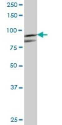 Western Blot: Muscle Phosphofructokinase/PFKM/PFK-1 Antibody [H00005213-B01P] - Analysis of PFKM expression in rat brain.