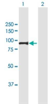 Western Blot: Muscle Phosphofructokinase/PFKM/PFK-1 Antibody [H00005213-B01P] - Analysis of PFKM expression in transfected 293T cell line by PFKM polyclonal antibody.  Lane 1: PFKM transfected lysate(85.8 KDa). Lane 2: Non-transfected lysate.