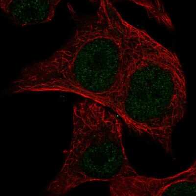 Immunocytochemistry/Immunofluorescence: Musculin Antibody [NBP2-56244] - Staining of human cell line SK-MEL-30 shows localization to nucleoplasm.