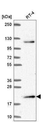 Western Blot: Musculin Antibody [NBP2-56244] - Western blot analysis in human cell line RT-4.