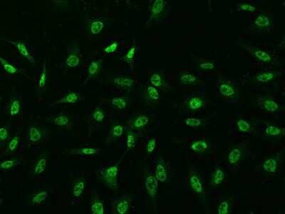 Immunocytochemistry/Immunofluorescence: Mxi1 Antibody [NBP2-97478] - Immunofluorescence staining of Mxi1 in Hela cells. Cells were fixed with 4% PFA, permeabilzed with 0.1% Triton X-100 in PBS, blocked with 10% serum, and incubated with rabbit anti-Human Mxi1 polyclonal antibody (dilution ratio 1:200) at 4C overnight. Then cells were stained with the Alexa Fluor(R)488-conjugated Goat Anti-rabbit IgG secondary antibody (green). Positive staining was localized to Nucleus .