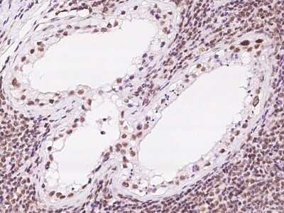 Immunohistochemistry-Paraffin: Mxi1 Antibody [NBP2-97478] - Immunochemical staining of human Mxi1 in human testis with rabbit polyclonal antibody at 1:100 dilution, formalin-fixed paraffin embedded sections.