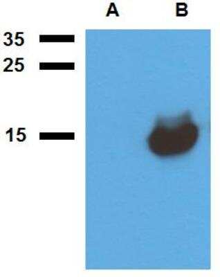 Western Blot: Mycobacterium tuberculosis antigen Acr1 Antibody [NBP2-62180] - Analysis of polyclonal anti-Mycobacterium tuberculosis antigen Acr1. A) cell lysate of non-transfected E. coliB) cell lysate of Acr1-transfected E. coli