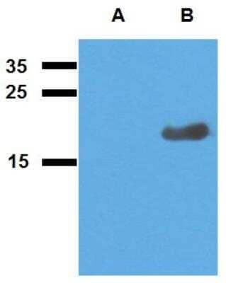 Western Blot: Mycobacterium tuberculosis antigen Acr2 Antibody [NBP2-62182] - Analysis of polyclonal anti-Mycobacterium tuberculosis antigen Acr2. A) cell lysate of non-transfected E. coliB) cell lysate of Acr2-transfected E. coli