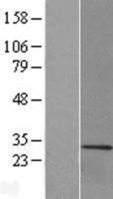 Western Blot MBP Overexpression Lysate