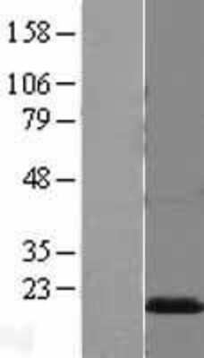 Western Blot: Myelin P2 Protein Overexpression Lysate (Adult Normal) [NBL1-14538] Left-Empty vector transfected control cell lysate (HEK293 cell lysate); Right -Over-expression Lysate for Myelin P2 Protein.