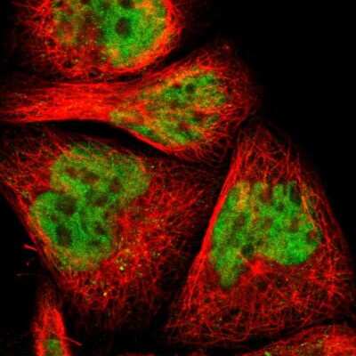 Immunocytochemistry/Immunofluorescence: Myelin expression factor 2 Antibody [NBP1-83766] - Immunofluorescent staining of human cell line A-431 shows localization to nucleoplasm.