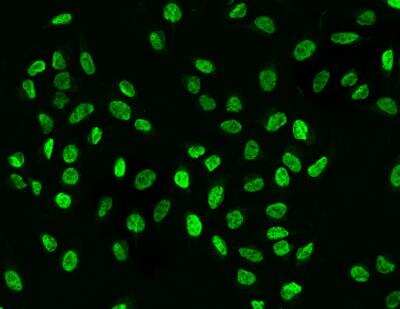 Immunocytochemistry/Immunofluorescence: Myelin expression factor 2 Antibody [NBP3-12682] - Staining of MYEF2 in U2OS cells. Cells were fixed with 4% PFA, permeabilzed with 0.3% Triton X-100 in PBS,blocked with 10% serum, and incubated with rabbit anti-Human MYEF2 polyclonal antibody (dilution ratio 1:200) at 4? overnight. Then cells were stained with the Alexa Fluor®488-conjugated Goat Anti-rabbit IgG secondary antibody (green). Positive staining was localized to Nucleus.