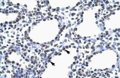 Immunohistochemistry: Myelin expression factor 2 Antibody [NBP2-87864] - Human Lung