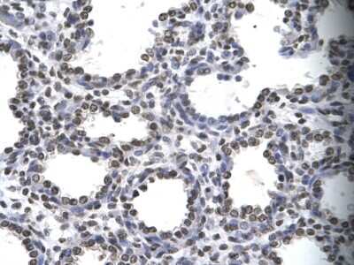 Immunohistochemistry-Paraffin: Myelin expression factor 2 Antibody [NBP2-87864] - Rabbit Anti-MYEF2 Antibody. Paraffin Embedded Tissue: Human alveolar cell. Cellular Data: Epithelial cells of renal tubule. Antibody Concentration: 4.0-8.0 ug/ml. Magnification: 400X