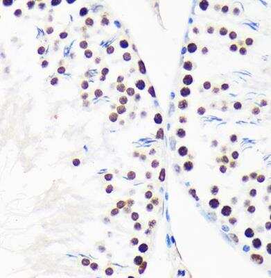 Immunohistochemistry-Paraffin: Myelin expression factor 2 Antibody [NBP2-93986] - Rat testis using MYEF2 Rabbit pAb at dilution of 1:100 (40x lens).