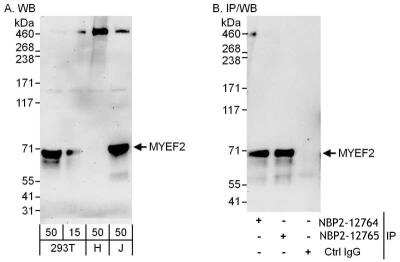 Immunoprecipitation: Myelin expression factor 2 Antibody [NBP2-12764] - Samples: Whole cell lysate from 293T (15 and 50 ug for WB; 1 mg for IP, 20% of IP loaded), HeLa (H; 50 ug) and Jurkat (J; 50 ug) cells. Antibodies: Affinity purified rabbit anti-MYEF2 antibody NBP2-12764 used for WB at 0.1 ug/ml (A) and 1 ug/ml (B) and used for IP at 6 ug/mg lysate. MYEF2 was also immunoprecipitated by rabbit anti-MYEF2 antibody NBP2-12765, which recognizes a downstream epitope. Detection: Chemiluminescence with exposure times of 3 minutes (A) and 30 seconds (B).