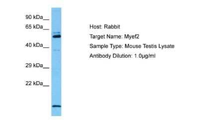 Western Blot: Myelin expression factor 2 Antibody [NBP2-87864] - Host: Mouse. Target Name: MYEF2. Sample Tissue: Mouse Testis. Antibody Dilution: 1ug/ml