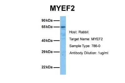 Western Blot: Myelin expression factor 2 Antibody [NBP2-87864] - Host: Rabbit. Target Name: MYEF2. Sample Tissue: Human 786-0. Antibody Dilution: 1.0ug/ml