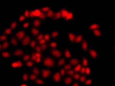 Immunocytochemistry/Immunofluorescence: Myeloid leukemia factor 1 Antibody [NBP2-93971] - Analysis of A549 cells using Myeloid leukemia factor 1 .