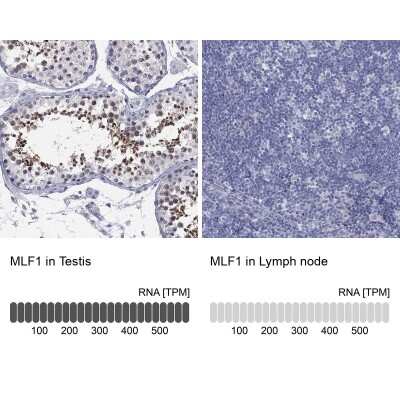 Immunocytochemistry/Immunofluorescence: Myeloid leukemia factor 1 Antibody [NBP3-17083] - Analysis in human testis and lymph node tissues using Anti-MLF1 antibody. Corresponding MLF1 RNA-seq data are presented for the same tissues.