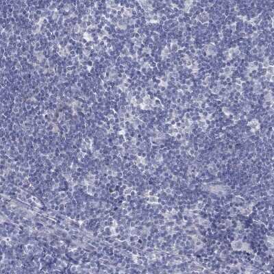 Immunohistochemistry-Paraffin: Myeloid leukemia factor 1 Antibody [NBP3-17083] - Staining of human lymph node shows low expression as expected.
