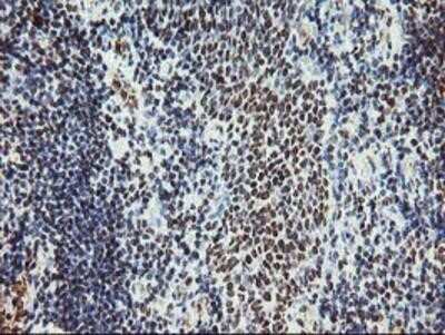Immunohistochemistry: Myeloid leukemia factor 1 Antibody (OTI3A3) - Azide and BSA Free [NBP2-72846] - Staining of paraffin-embedded Human tonsil using anti-Myeloid leukemia factor 1 mouse monoclonal antibody.