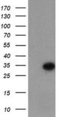 Western Blot: Myeloid leukemia factor 1 Antibody (OTI3A3) - Azide and BSA Free [NBP2-72846] - HEK293T cells were transfected with the pCMV6-ENTRY control (Left lane) or pCMV6-ENTRY Myeloid leukemia factor 1 (Right lane) cDNA for 48 hrs and lysed. Equivalent amounts of cell lysates (5 ug per lane) were separated by SDS-PAGE and immunoblotted with a