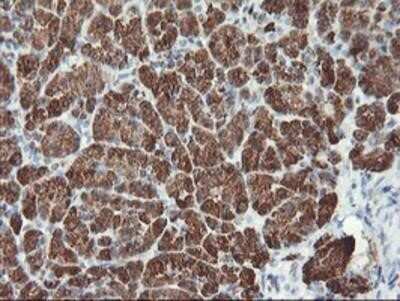 Immunohistochemistry-Paraffin: Myeloid leukemia factor 1 Antibody (OTI3A3) [NBP2-02052] - Staining of paraffin-embedded Human pancreas tissue using anti-Myeloid leukemia factor 1 mouse monoclonal antibody.