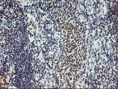 Immunohistochemistry-Paraffin: Myeloid leukemia factor 1 Antibody (OTI3A3) [NBP2-02052] - Staining of paraffin-embedded Human tonsil using anti-Myeloid leukemia factor 1 mouse monoclonal antibody.
