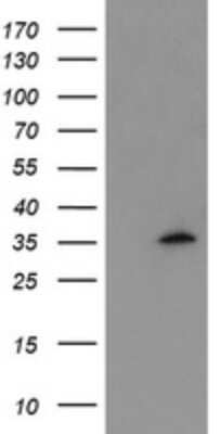 Western Blot: Myeloid leukemia factor 1 Antibody (OTI3F11) - Azide and BSA Free [NBP2-72849] - Analysis of HEK293T cells were transfected with the pCMV6-ENTRY control (Left lane) or pCMV6-ENTRY Myeloid leukemia factor 1.