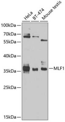 Western Blot: Myeloid leukemia factor 1 Antibody [NBP2-93724] - Analysis of extracts of various cell lines, using Myeloid leukemia factor 1 at 1:1000 dilution.Secondary antibody: HRP Goat Anti-Rabbit IgG (H+L) at 1:10000 dilution.Lysates/proteins: 25ug per lane.Blocking buffer: 3% nonfat dry milk in TBST.Detection: ECL Basic Kit .Exposure time: 90s.