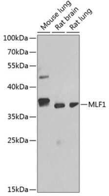 Western Blot: Myeloid leukemia factor 1 Antibody [NBP2-93971] - Analysis of extracts of various cell lines, using Myeloid leukemia factor 1 at 1:1000 dilution.Secondary antibody: HRP Goat Anti-Rabbit IgG (H+L) at 1:10000 dilution.Lysates/proteins: 25ug per lane.Blocking buffer: 3% nonfat dry milk in TBST.Detection: ECL Basic Kit .Exposure time: 90s.