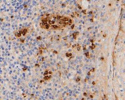 Immunohistochemistry-Paraffin: Myeloperoxidase/MPO Antibody (A1F2) [NBP2-89126] - Analysis of paraffin-embedded human tonsil tissue using anti-Myeloperoxidase antibody. The section was pre-treated using heat mediated antigen retrieval with Tris-EDTA buffer (pH 8.0-8.4) for 20 minutes.The tissues were blocked in 5% BSA for 30 minutes at room temperature, washed with ddH2O and PBS, and then probed with the primary antibody( 1/50) for 30 minutes at room temperature. The detection was performed using an HRP conjugated compact polymer system. DAB was used as the chromogen. Tissues were counterstained with hematoxylin and mounted with DPX.