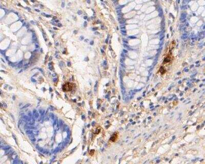 Immunohistochemistry-Paraffin: Myeloperoxidase/MPO Antibody (A1F2) [NBP2-89126] - Analysis of paraffin-embedded human colon tissue using anti-Myeloperoxidase antibody. The section was pre-treated using heat mediated antigen retrieval with Tris-EDTA buffer (pH 8.0-8.4) for 20 minutes.The tissues were blocked in 5% BSA for 30 minutes at room temperature, washed with ddH2O and PBS, and then probed with the primary antibody( 1/50) for 30 minutes at room temperature. The detection was performed using an HRP conjugated compact polymer system. DAB was used as the chromogen. Tissues were counterstained with hematoxylin and mounted with DPX.