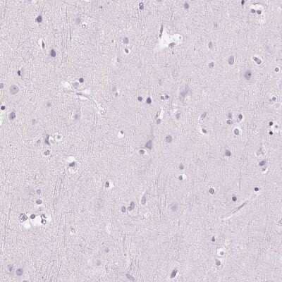 Immunohistochemistry-Paraffin: Myeloperoxidase/MPO Antibody [NBP1-87556] - Staining of human cerebral cortex shows low expression as expected.