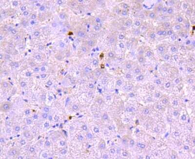 Immunohistochemistry-Paraffin: Myeloperoxidase/MPO Antibody (JM10-58) [NBP2-66964] - Analysis of paraffin-embedded human liver tissue using anti-Myeloperoxidase antibody. Counter stained with hematoxylin.
